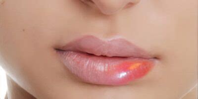 Unusual Factors Leading to Lip Swelling