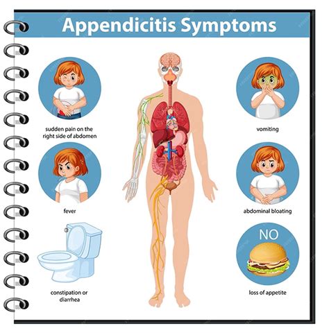 Unveiling Appendicitis: Exploring the Causes and Symptoms of this Prevalent Condition