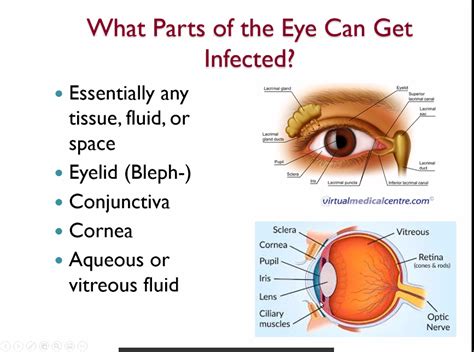 Unveiling the Causes: How Infections With Ocular Parasites Occur