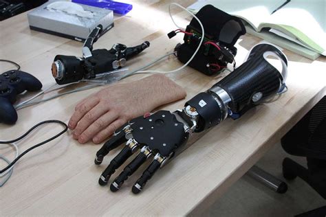 Unveiling the Latest Advancements in Robotic Limb Technology