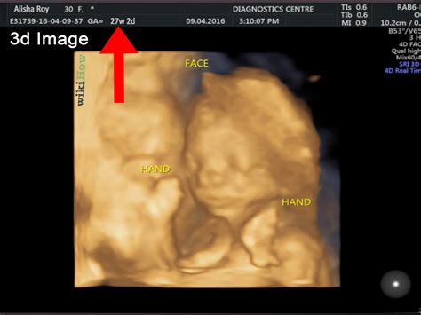 Unveiling the Secrets Inside the Womb: Exploring the Hidden Insights of Sonogram Images