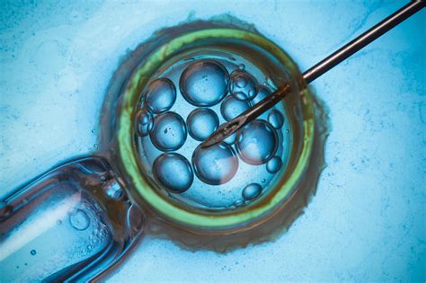 Unveiling the Secrets of Assisted Reproductive Technologies