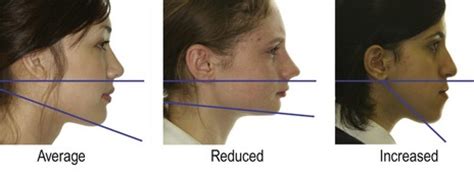 Vertical Measurements and Physical Presence