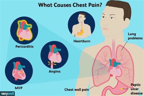 When Should Experiencing Discomfort in the Chest during Dreams Be a Matter of Concern?