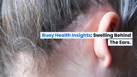 When to Seek Medical Attention for Ear Swelling: Signs and Red Flags