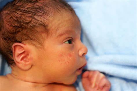 When to Seek Medical Help: Identifying Baby Skin Conditions Requiring a Doctor's Attention