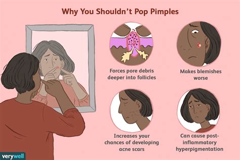 Why Do We Fantasize About Pimple Popping?