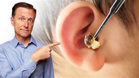 Why Does Wax Accumulation in the Ear Often Occur?