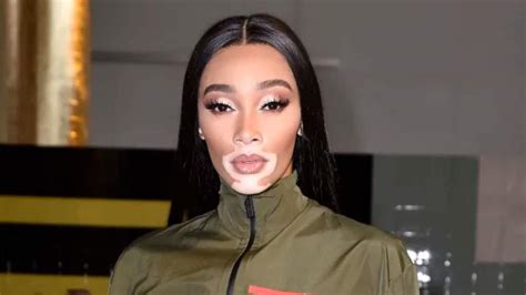 Winnie Harlow's Height and Body Measurements